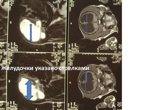 Полезные методы лечения и профилактики гидроцефалии
