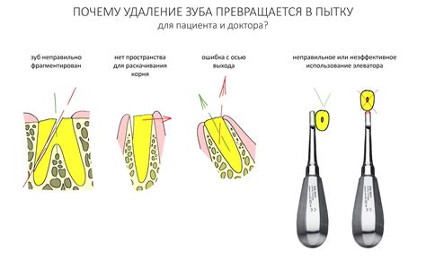 Удаление эскизов в несколько шагов