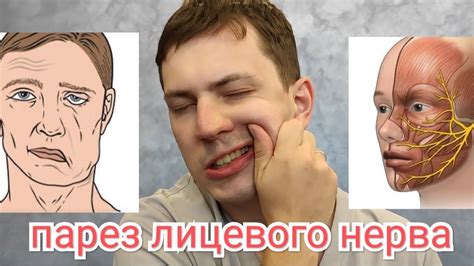 Восстановление лица после пыток