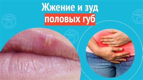 Зуд, жжение и покраснение в месте образования волдырей