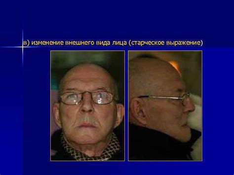 Изменение внешнего вида лица Гриффита