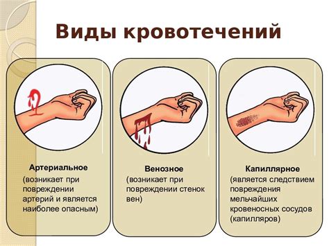 Как остановить потекшую ручку