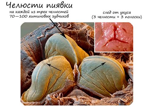 Как предотвратить сильный зуд во время укуса пиявки
