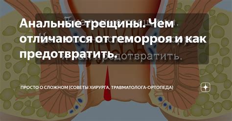 Как предотвратить трещины на мартинсах: Полезные советы