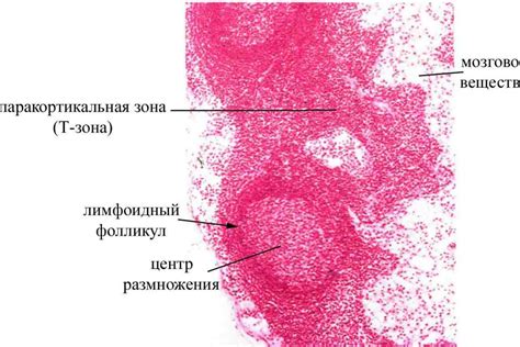 Лимфофолликулярная гиперплазия