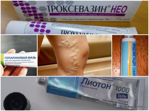 Медицинские мази и кремы для купирования дискомфорта