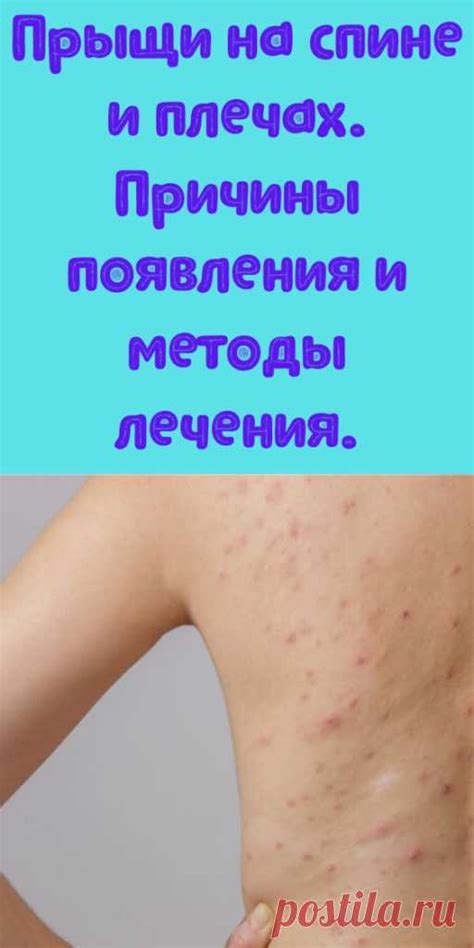 Методы лечения волдырей на спине