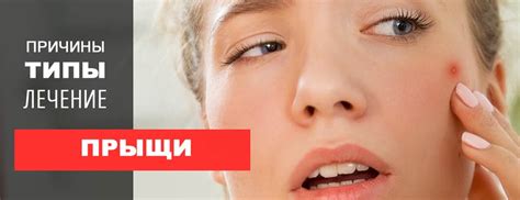 Основные причины кровоточивости прыщей