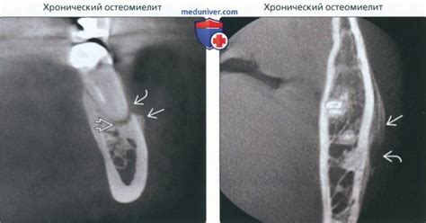 Основные симптомы и последствия отсутствия периостальной реакции