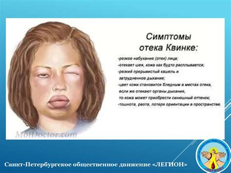 Отравления и аллергические реакции