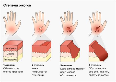 Первая помощь после ожога слизистой оболочки у собаки