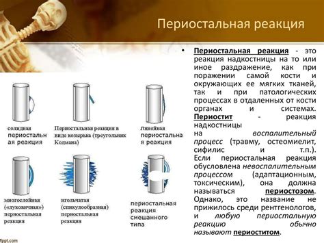 Периостальная реакция: ее отсутствие, возможные причины и особенности