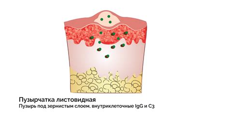 Появление болезненных пузырей на коже