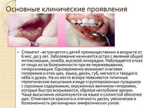 Раздражение кожи и слизистых оболочек