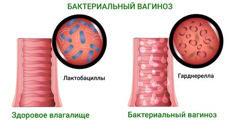 Участки микрофлоры: как не допустить нежелательное размножение