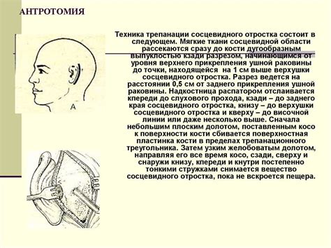 Факторы, влияющие на пневматизацию сосцевидных отростков височных костей